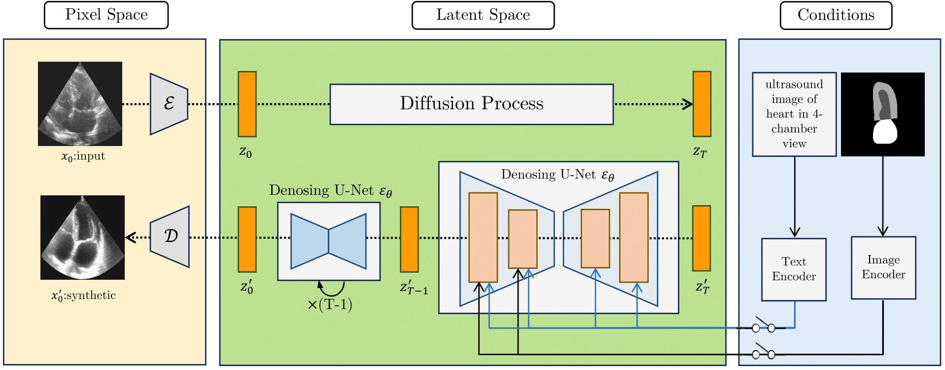 Vision-Language Ultrasound teaser